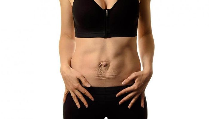 Diástase Abdominal: o que é, por que acontece e como a fisioterapia pode ajudar